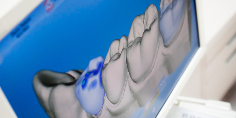 Digital X-ray Of Human Teeth - Dental Laboratory in Bolton